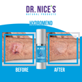 HydroMend (Wound Care for Seniors)